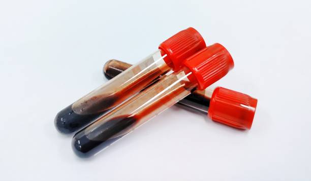 próbki krwi - blood sample blood tube pathologist zdjęcia i obrazy z banku zdjęć