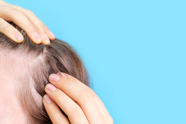 Girl touching her hair close-up on blue background, hair loss concept. stock photo
