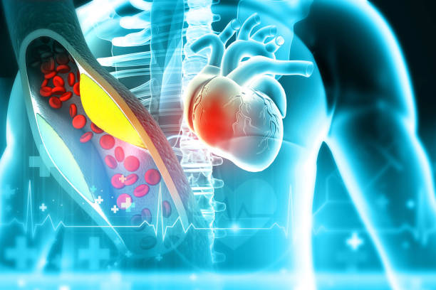 istock Cholesterol blocked arteries with human heart 1471588870