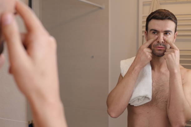 istock Man pointing to dark circles 1471731481
