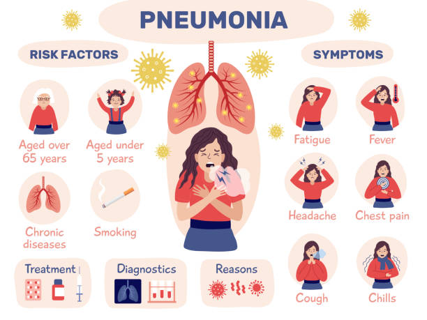 Pneumonia infographic. Health problem with lung bacterias attack human organs recent vector illustrations Pneumonia infographic. Health problem with lung bacterias attack human organs recent vector illustrations of infographic respiratory illness cold and flu stock illustrations