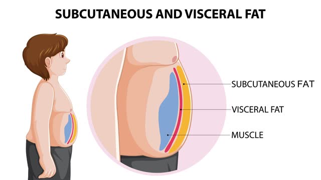 Diagram showing subcutaneous and visceral fat