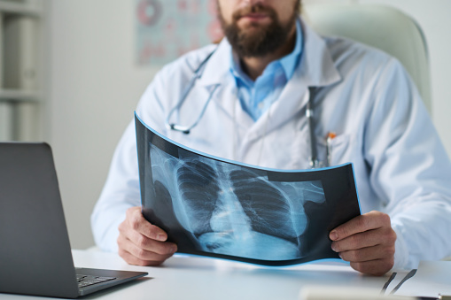Close-up of bearded male radiologist holding lung x-ray of online patient while making diagnosis by his workplace in front of laptop