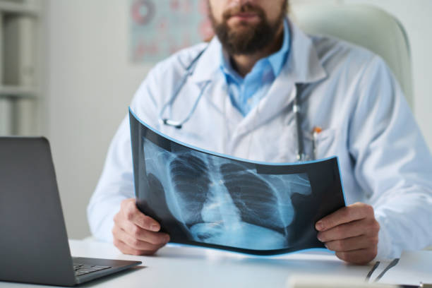 Close-up of bearded male radiologist holding lung x-ray of online patient stock photo