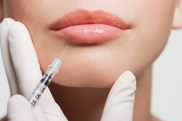 nahaufnahme von frau empfangende botox-spritze in den mund legen - woman face close up stock-fotos und bilder