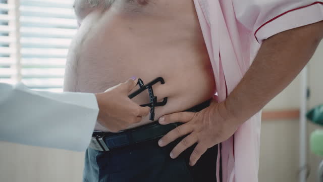 Latin female doctor's hand check patient's belly fat by using fat calipers, Asian man gets a health check by medical professionals after controlling nutrition, close-up view