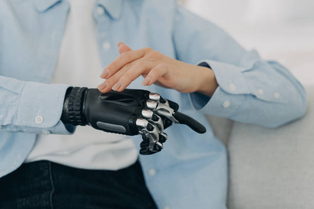 istock Girl is setting up her bionic hand and pressing buttons. Young woman with artificial arm at home. 1472244379