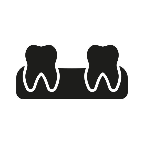 Missing Teeth in Gym Silhouette Icon. Human Tooth Lose Glyph Pictogram. Oral Disease. Lost Baby Tooth. Space between Teeth. Dental Treatment Solid Sign. Dentistry Symbol. Isolated Vector Illustration Missing Teeth in Gym Silhouette Icon. Human Tooth Lose Glyph Pictogram. Oral Disease. Lost Baby Tooth. Space between Teeth. Dental Treatment Solid Sign. Dentistry Symbol. Isolated Vector Illustration. lost in space stock illustrations