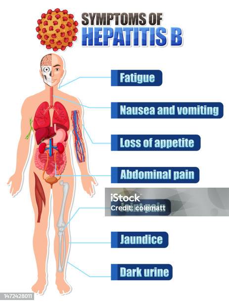 Informative Poster Of Common Symptoms Hepatitis B Stock Illustration - Download Image Now - Anatomy, Biology, Blood - iStock