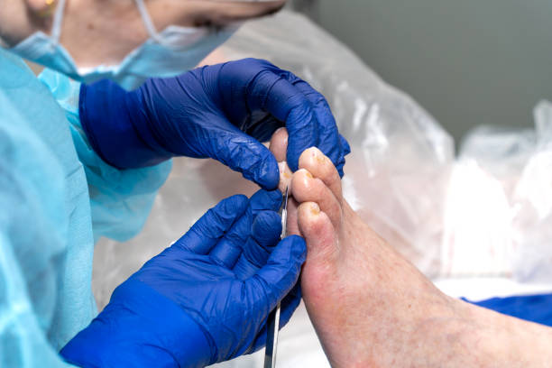 Podiatrist removing cuticle and dry skin on an older patient's nails in the clinic. stock photo