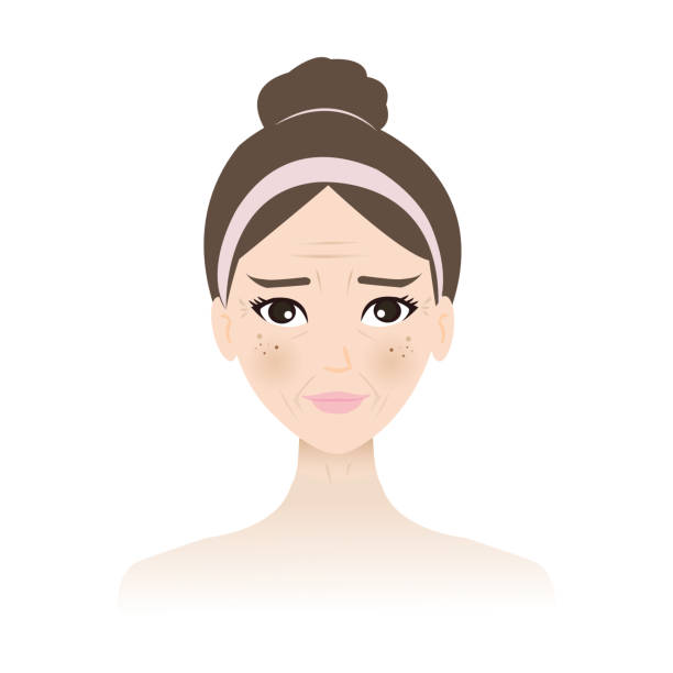 The aging on woman skin face vector illustration isolated on white background. The aging on woman skin face vector isolated on white background. The wrinkles, sagging, melasma, blemish, freckle, dark spots and damage skin. Skin care concept illustration. freckle stock illustrations