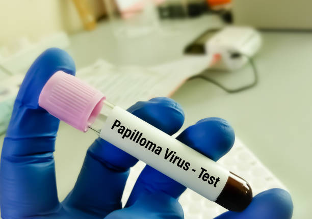 hpv virus (human papillomavirus) en tubo, concepto médico y de atención médica. - fotos de virus papiloma humano fotografías e imágenes de stock