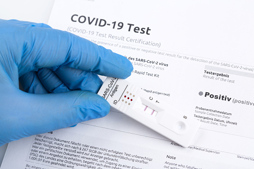 Express corona test. Positive covid antigen test.