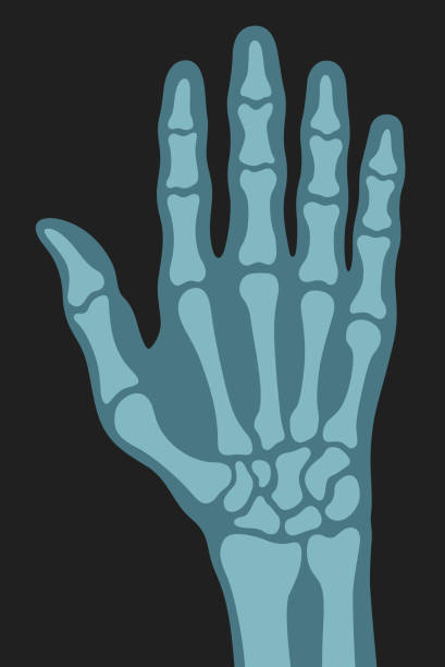 ilustrações de stock, clip art, desenhos animados e ícones de x ray right human hand ultra skeleton body bone roentgen front view vector flat illustration - human bone the human body healthcare and medicine human skeleton