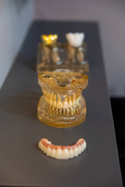 Natural prosthetic tooth models used in the dentistry industry stock photo