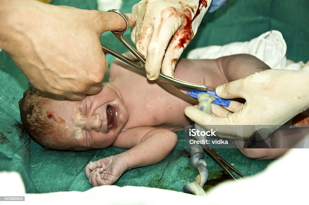 / a figlio/a alla nascita - Foto stock royalty-free di Cordone ombelicale
