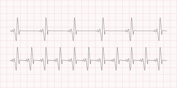 kardiogram, szívverés, elektrokardiogram piros hálóval - szívritmus vizsgálat témájú stock illusztrációk