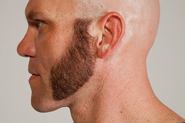 Mutton Chops Side-Burns Mutton Chops Side-Burns