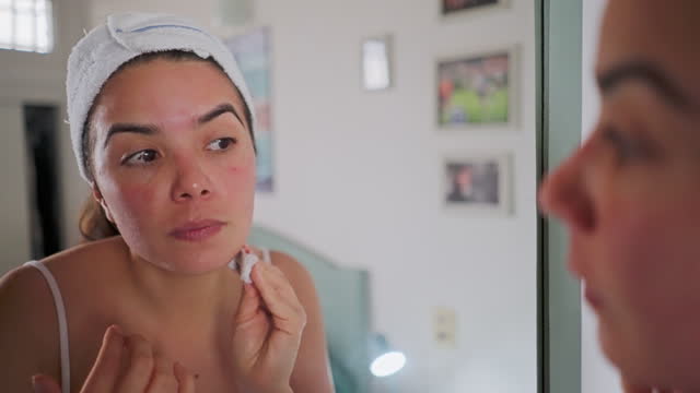 Hispanic young woman removing peel off residues from face with cotton pad after skin exfoliation and facial hair removal.