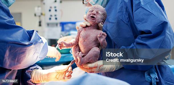 Niño Por Cesárea Foto de stock y más banco de imágenes de Cesárea - Cesárea, Recién nacido - 0-1 mes, Hospital