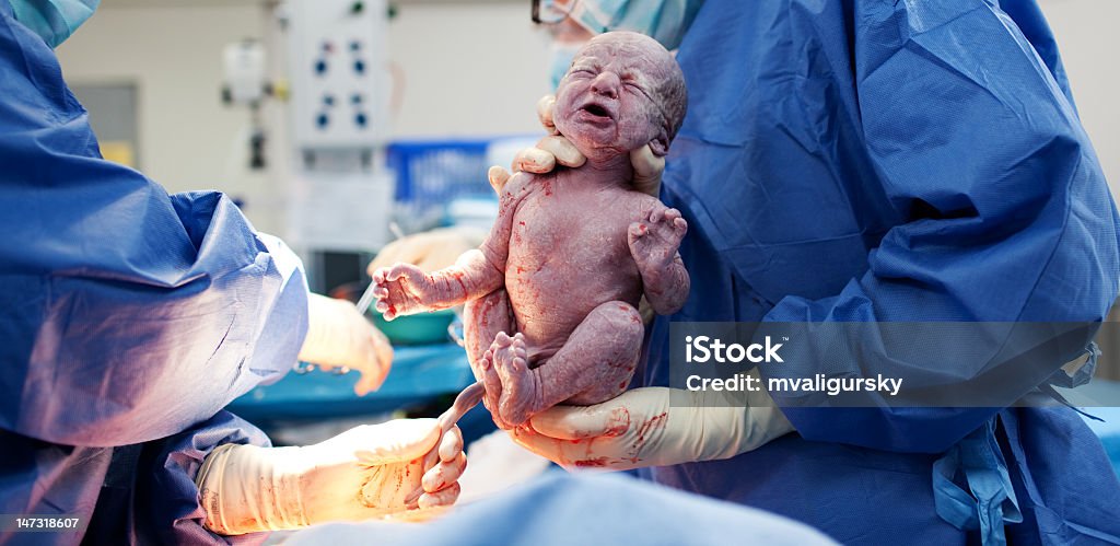 Bébé est né par Césarienne - Photo de Césarienne libre de droits