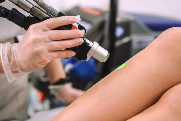 plan rapproché d’une main gantée avec la pièce à main de la machine d’épilation au laser le long de la jambe de la femme. technologie laser alexandrite enlevant les poils. procédure de beauté - beautiful the human body body care close up photos et images de collection