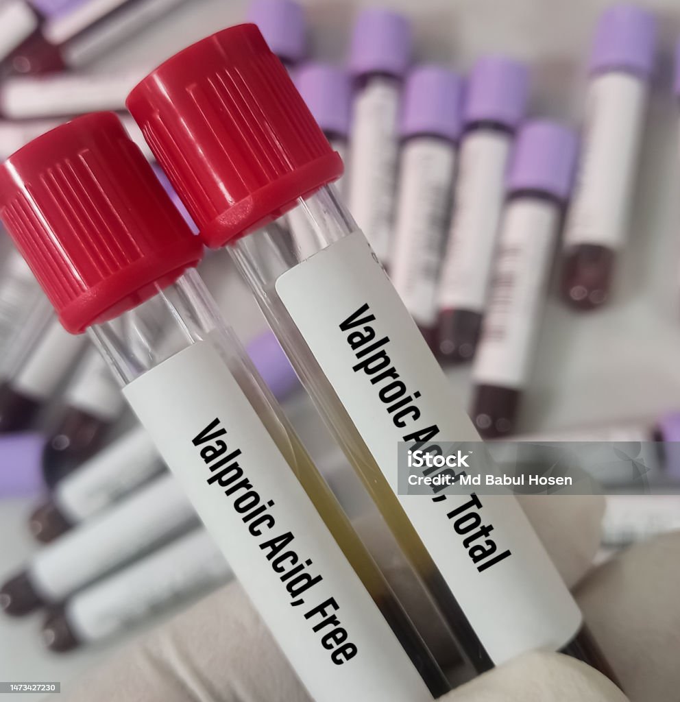 Blood Sample For Valproic Acid Test Stock Photo Download Image Now Blood Sample For Valproic Acid Test Stock Photo Download Image Now