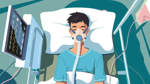 Vector illustration of COVID patient man lying in hospital bed with oxygen mask for artificial lungs ventilation from coronavirus disease top view. Unconscious person with corona virus pneumonia flat vector illustration