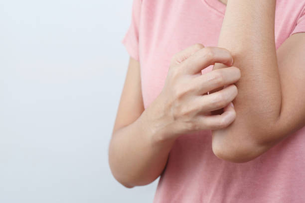 istock Health problems, woman has itchy hands 1473475555