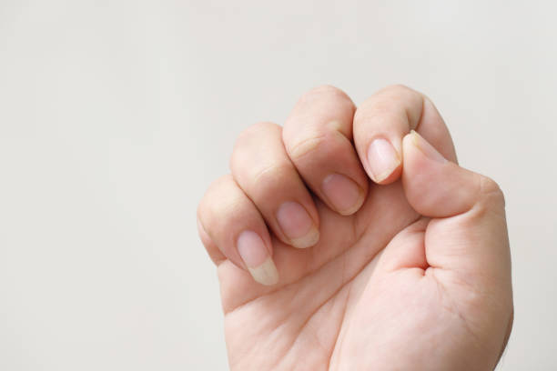 Problems with long, dirty fingernails and bacterial germs stock photo