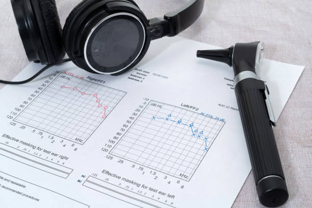 Audiology - headphones and an otoscope placed on an audiogram stock photo