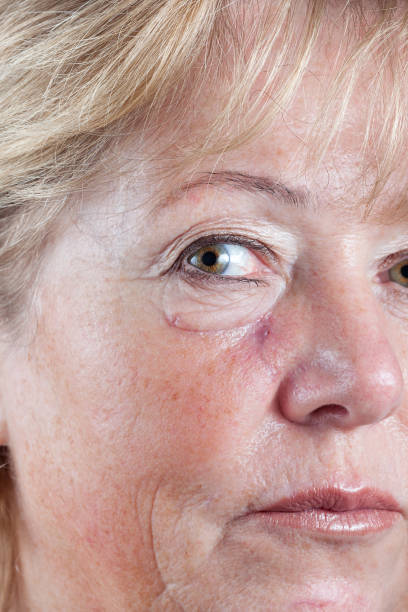 istock Surgery scar fading 1473555680