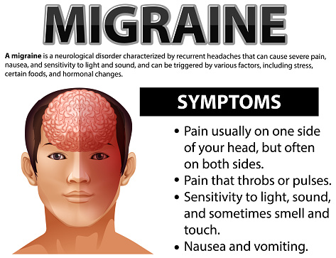 Informative poster of Migraine illustration