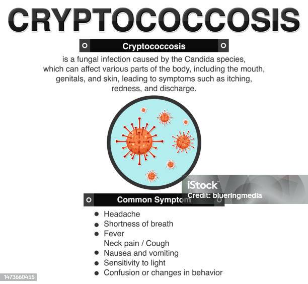 Ilustración de Póster Informativo De Criptococosis y más Vectores ...