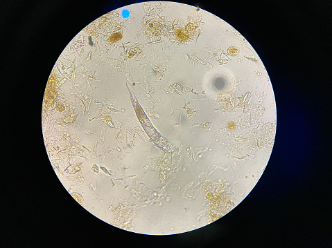 Sarna de Demodex desde una vista de microscopio. photo