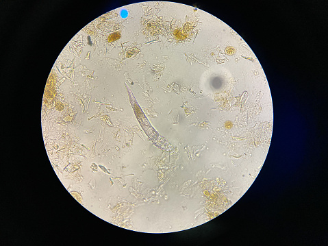 Demodex mange from a microscope view. The parasite causing a skin disease -Demodecosis.