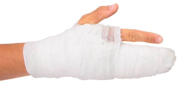 broken arm covered in white gypsum isolated - physical injury men orthopedic equipment isolated on white imagens e fotografias de stock