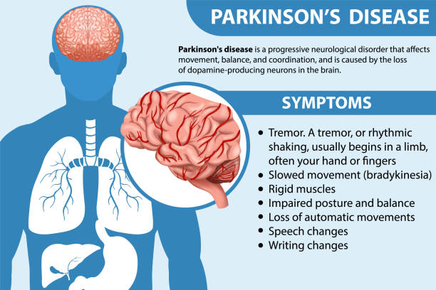 stockillustraties, clipart, cartoons en iconen met informative poster of parkinson disease - parkinson