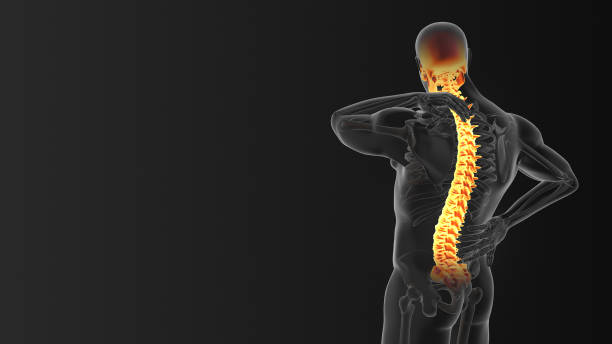 conceito médico de dor no pescoço e nas articulações das costas - x ray image x ray back low - fotografias e filmes do acervo