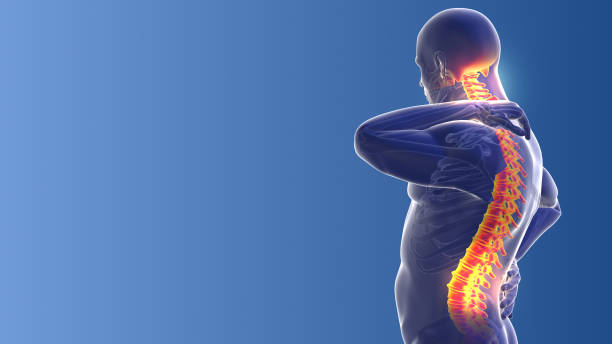 neck and back joint pain medical background - low back imagens e fotografias de stock