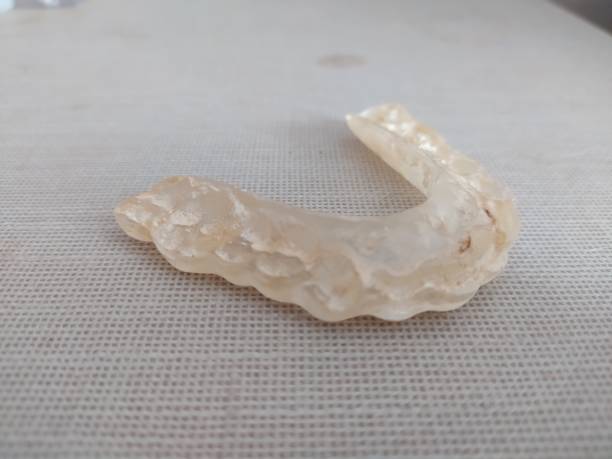 istock Old and yellow mouth guard for clenching teeth 1474249176