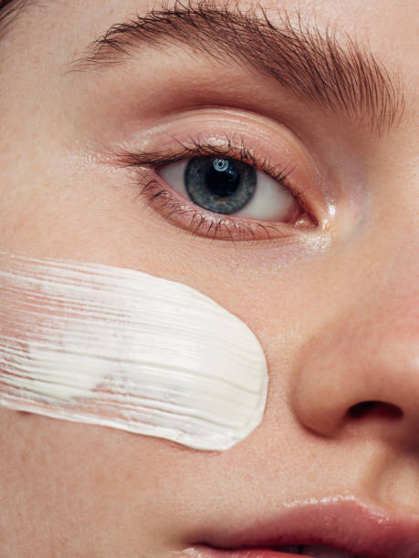 istock Girl inflicting cream 1474300314