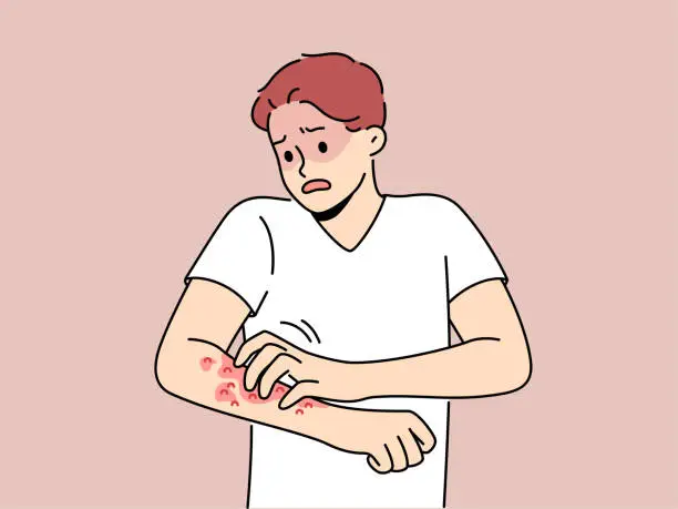 Vector illustration of Unhealthy man scratch redness on arms