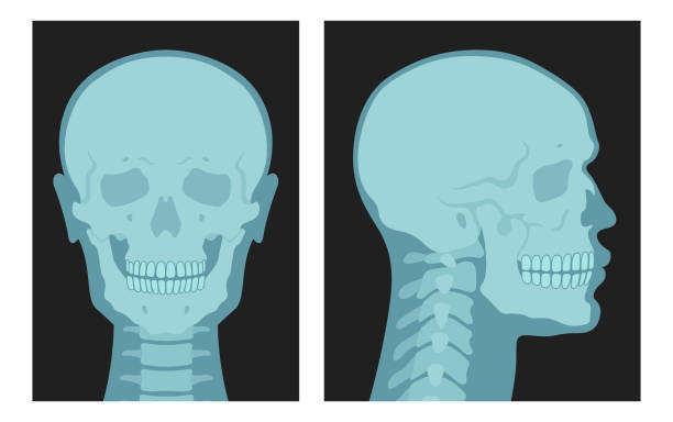 ilustrações de stock, clip art, desenhos animados e ícones de x rays shots of human skull front side view set vector flat illustration. skeleton bone roentgen - human bone the human body healthcare and medicine human skeleton