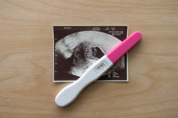 두 개의 줄무늬가 있는 임신 테스트, 긍정적인 결과, 나무 배경에 아기 초음파 스캔 사진. 클로즈업, 시점 촬영, 하향식 보기. - abdomen gynecological examination women loving 뉴스 사진 이미지