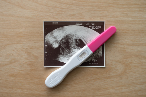 Pregnancy test with two stripes, Positive result, and Baby ultrasound scan photo on wooden background. Closeup, Point of view shot, Top down view.