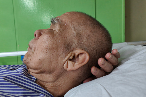 An Asian senior man hospitalized overnight in hospital due for fasting for medical check-up