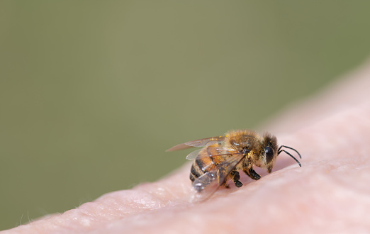 The bee is affected by the varroa mite and a piece of beeswax in the beekeeper's hand. Varroa mite causes serious damage to bee colonies and apiaries.