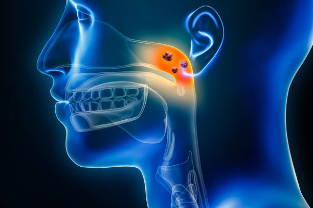 rak nosogardzieli z narządami i guzami lub komórkami nowotworowymi ilustracja renderowania 3d. anatomia, onkologia, choroby gardła, medycyna, biologia, nauka, koncepcje opieki zdrowotnej. - nasopharynx zdjęcia i obrazy z banku zdjęć