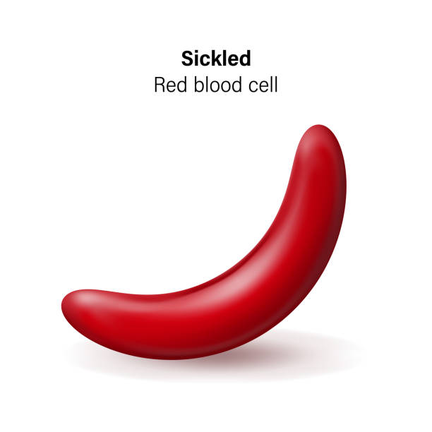 ilustraciones, imágenes clip art, dibujos animados e iconos de stock de enfermedad de células falciformes. vector de glóbulos rojos falciformes. - sickle cell anemia red blood cell blood cell anemia